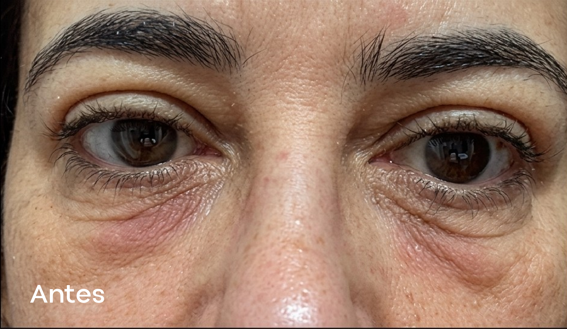 Resultados faciales