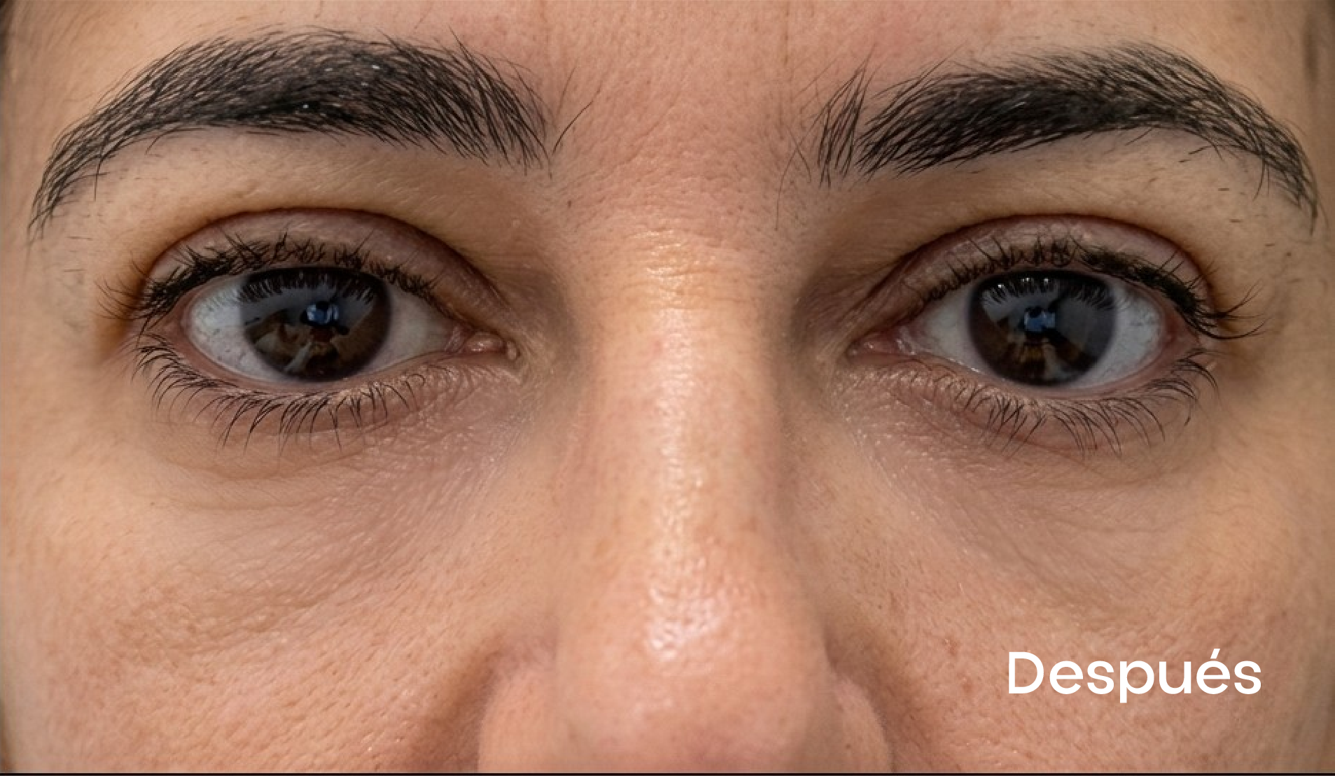 Resultados faciales
