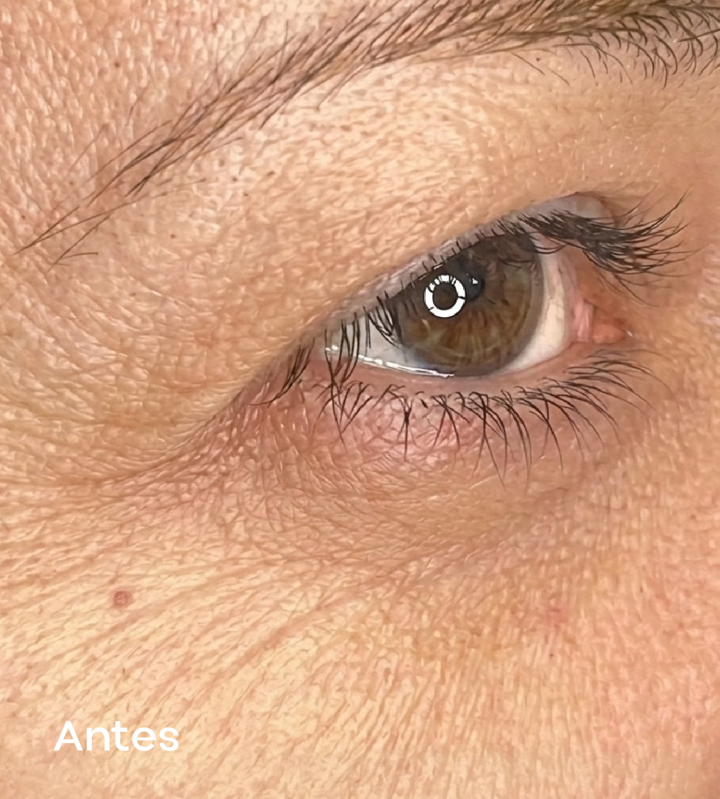 Resultados faciales