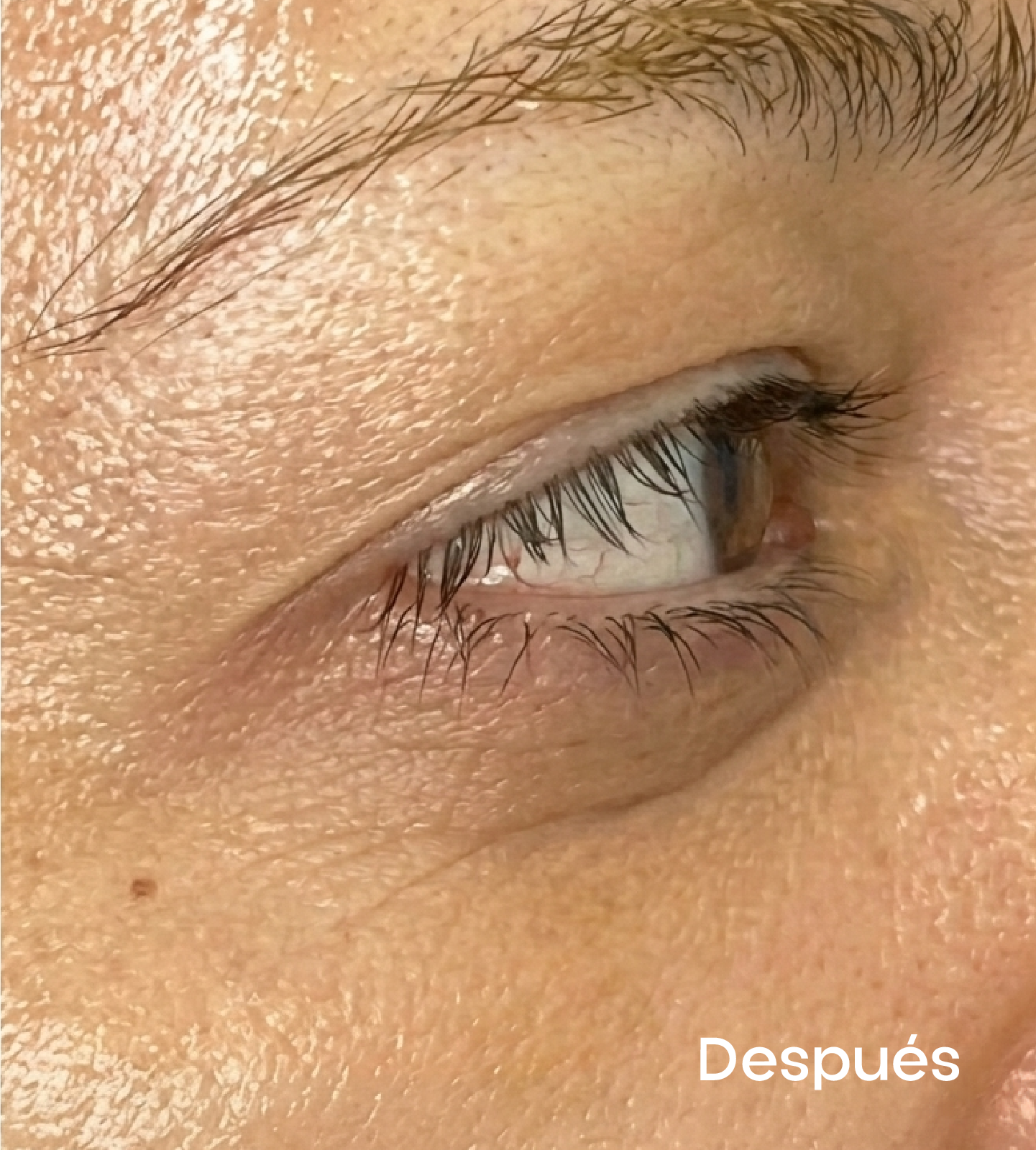 Resultados faciales