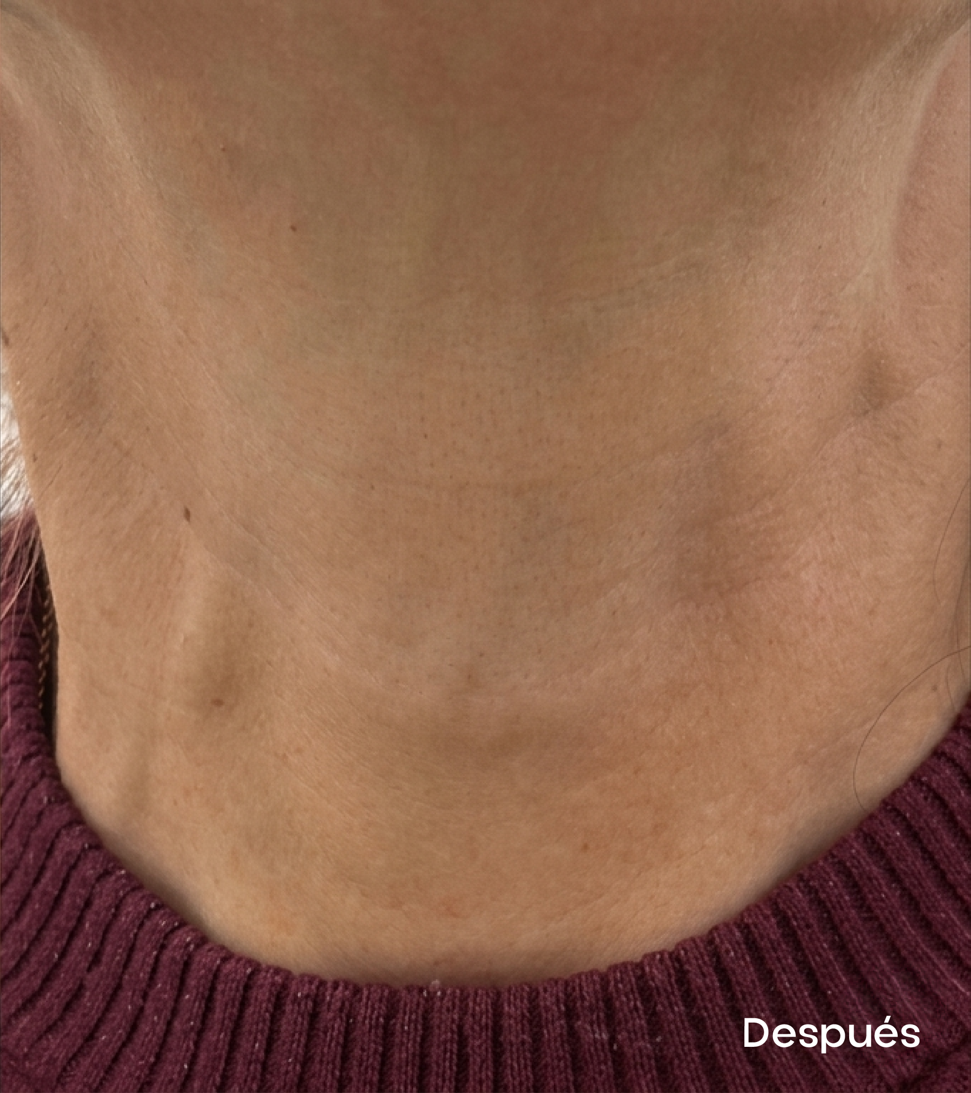 Resultados faciales