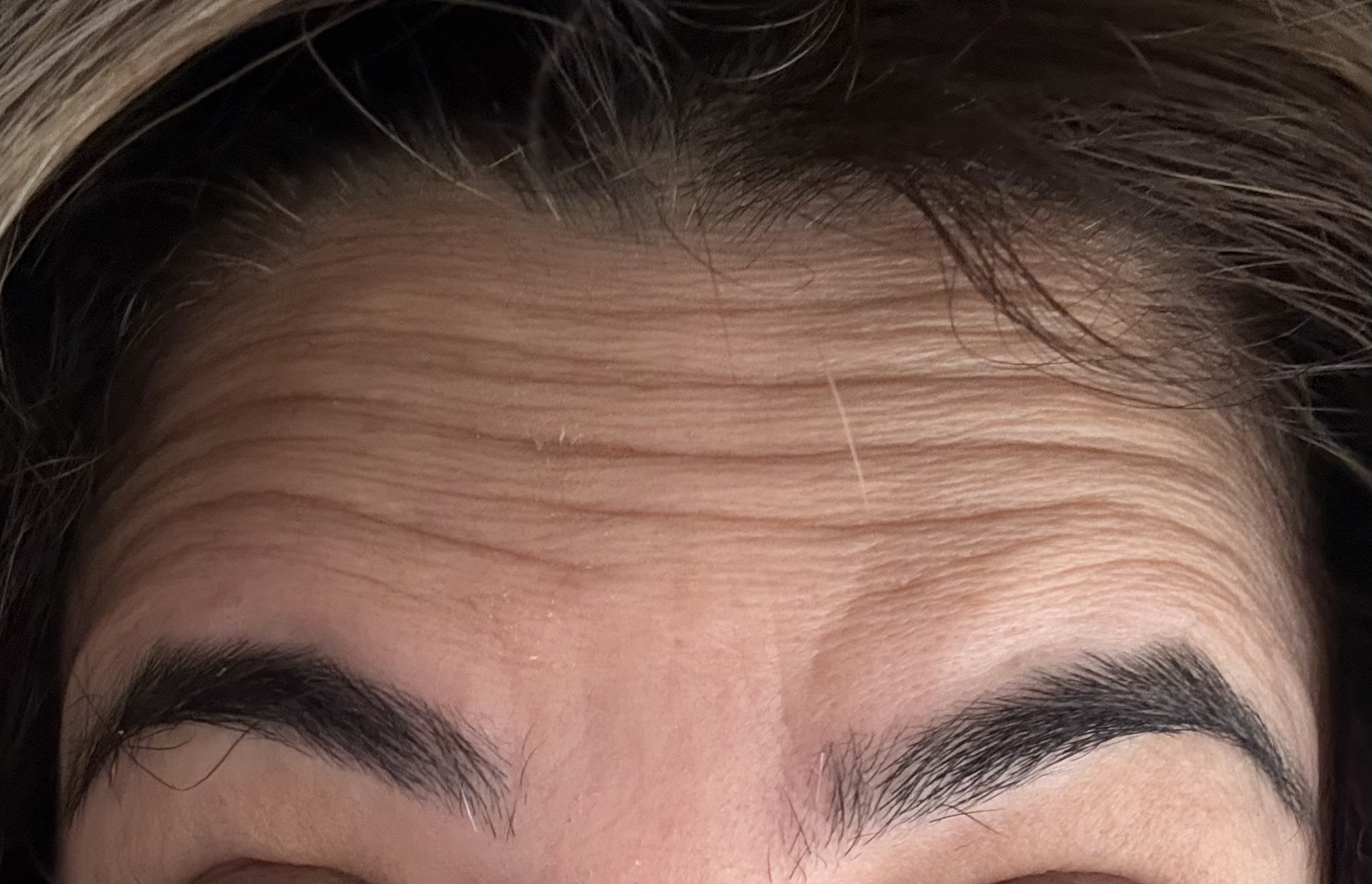 Resultados faciales